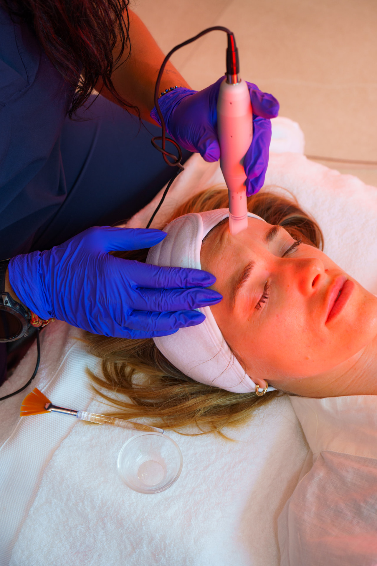 Indiba facial diario